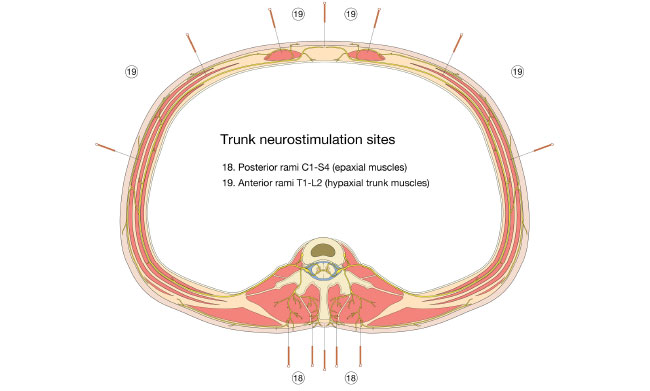 Trunk Neurostimulation Sites Trunk Neurostimulation Sites