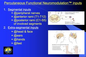 Percutaneous Functional Neuromodulation™ Inputs