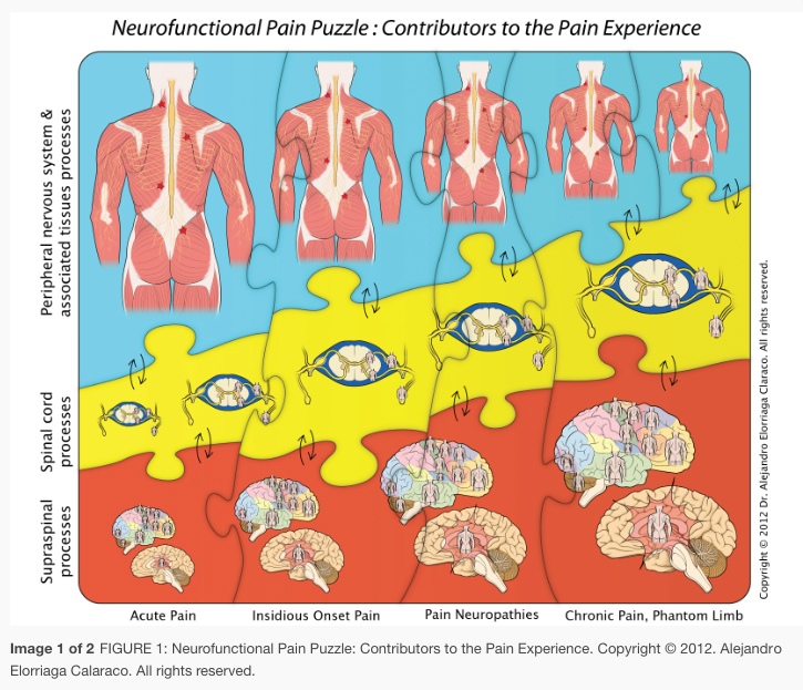 Neurofunctional Pain Puzzle